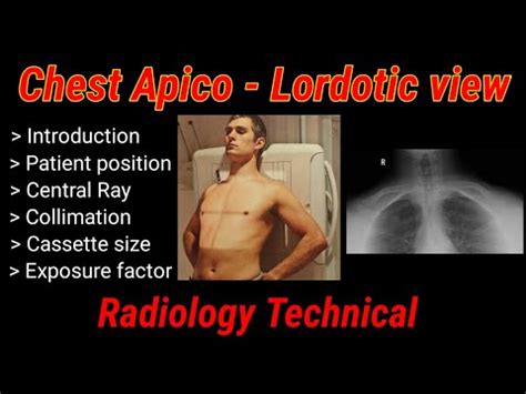 for apicolordotic view|Chest X.